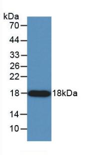 Angiogenin (ANG) Human Monoclonal Antibody