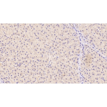 Angiogenin (ANG) Human Monoclonal Antibody