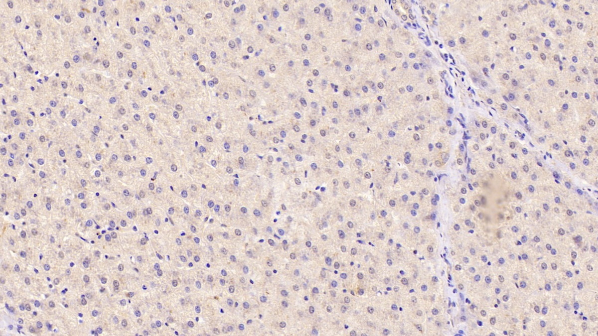 Angiogenin (ANG) Human Monoclonal Antibody