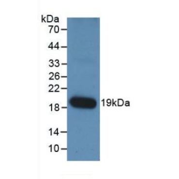Angiopoietin 1 (ANGPT1) Human Monoclonal Antibody
