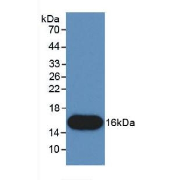 Connective Tissue Growth Factor (CTGF) Human Monoclonal Antibody