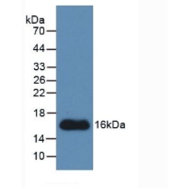 Connective Tissue Growth Factor (CTGF) Human Monoclonal Antibody