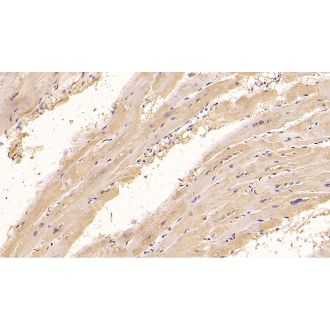 Connective Tissue Growth Factor (CTGF) Human Monoclonal Antibody