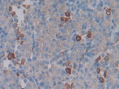 Connective Tissue Growth Factor (CTGF) Rat Monoclonal Antibody