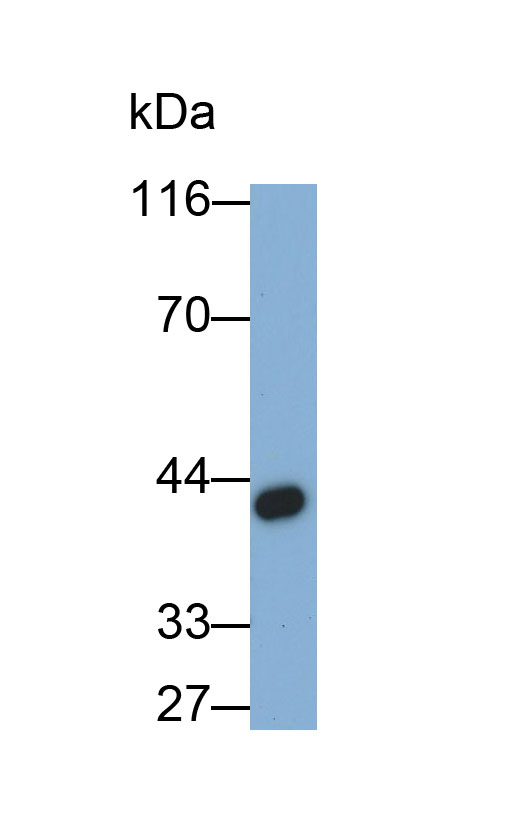 Brain Derived Neurotrophic Factor (BDNF) Rat Monoclonal Antibody