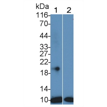 S100 Calcium Binding Protein (S100) Human Monoclonal Antibody