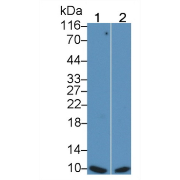 S100 Calcium Binding Protein (S100) Human Monoclonal Antibody
