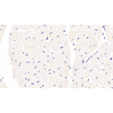 S100 Calcium Binding Protein (S100) Human Monoclonal Antibody