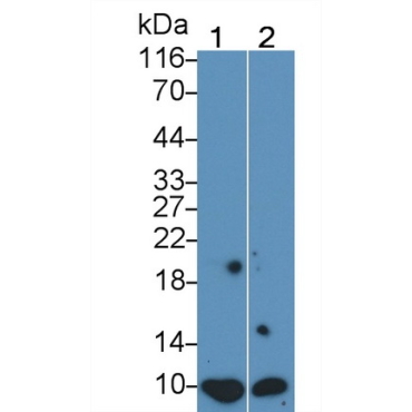 S100 Calcium Binding Protein (S100) Human Monoclonal Antibody