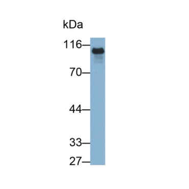 E-cadherin Human Monoclonal Antibody