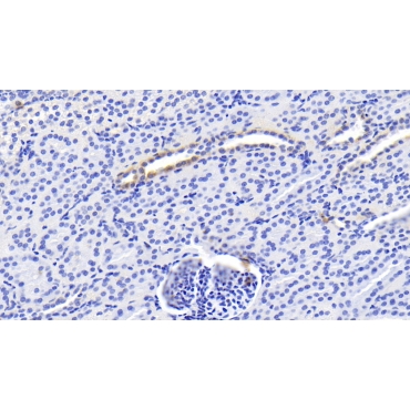 Erythropoietin (EPO) Human Monoclonal Antibody