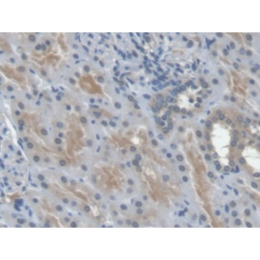 Erythropoietin (EPO) Human Monoclonal Antibody