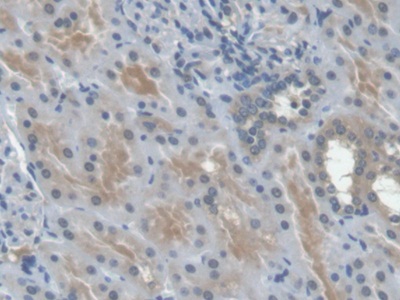 Erythropoietin (EPO) Human Monoclonal Antibody