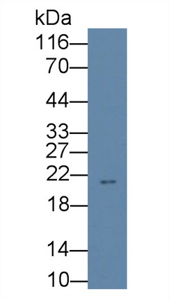 Erythropoietin (EPO) Human Monoclonal Antibody