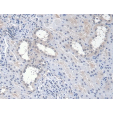 Erythropoietin (EPO) Human Monoclonal Antibody