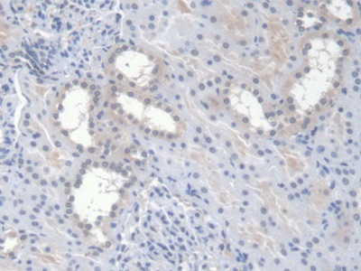 Erythropoietin (EPO) Human Monoclonal Antibody
