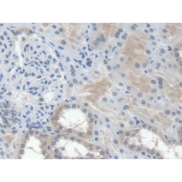 Erythropoietin (EPO) Human Monoclonal Antibody