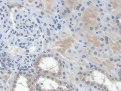 Erythropoietin (EPO) Human Monoclonal Antibody