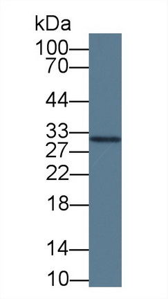 Erythropoietin (EPO) Human Monoclonal Antibody