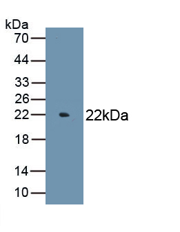 Erythropoietin (EPO) Rat Monoclonal Antibody