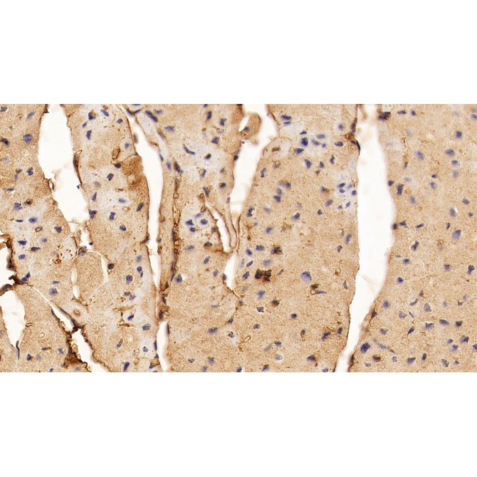 Fibroblast Growth Factor 1, Acidic (FGF1) Human Monoclonal Antibody