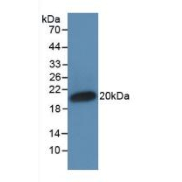 Interferon Alpha (IFNa) Human Monoclonal Antibody