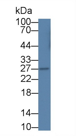 Interferon Alpha (IFNa) Rabbit Monoclonal Antibody