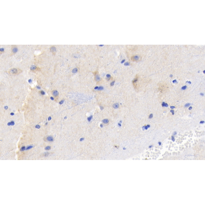 Fibroblast Growth Factor 9 (FGF9) Human Monoclonal Antibody