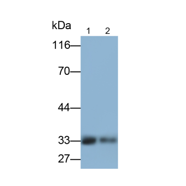 FMS Like Tyrosine Kinase 3 Ligand (Flt3L) Human Monoclonal Antibody