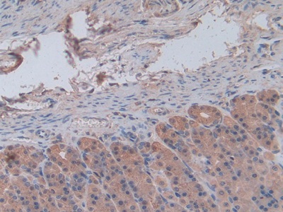 Chemokine (C-X-C Motif) Ligand 1 (CXCL1) Rat Monoclonal Antibody