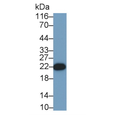 Growth Hormone (GH) Human Monoclonal Antibody