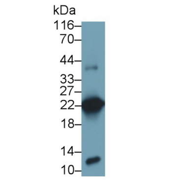 Growth Hormone (GH) Human Monoclonal Antibody