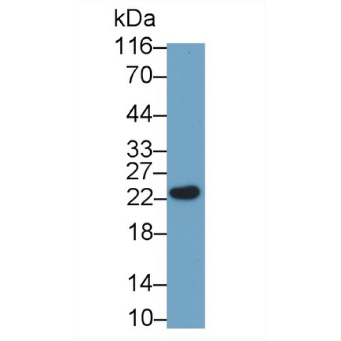 Growth Hormone (GH) Human Monoclonal Antibody