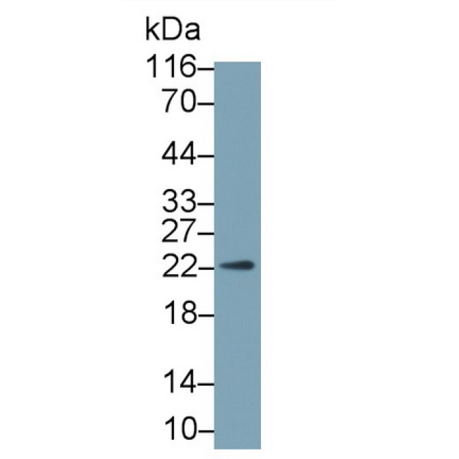 Growth Hormone (GH) Human Monoclonal Antibody