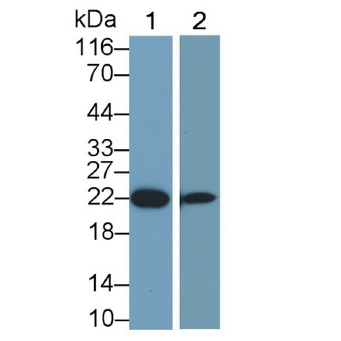Growth Hormone (GH) Human Monoclonal Antibody