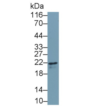 Interferon Gamma (IFNg) Human Monoclonal Antibody