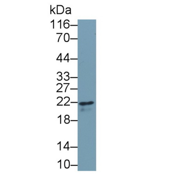 Interferon Gamma (IFNg) Human Monoclonal Antibody