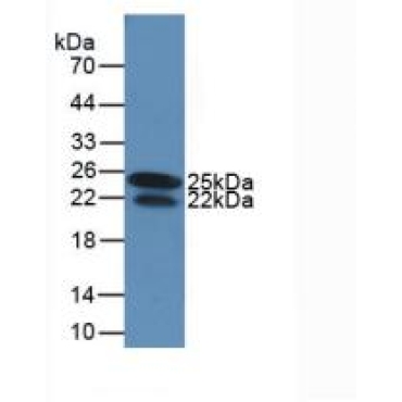 Interferon Gamma (IFNg) Human Monoclonal Antibody