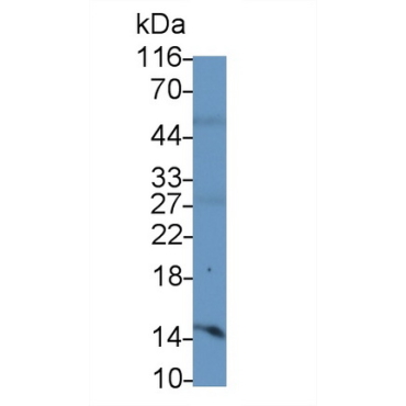 Interferon Gamma (IFNg) Mouse Monoclonal Antibody