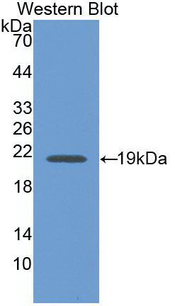 Interferon Gamma (IFNg) Rabbit Monoclonal Antibody