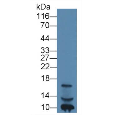 Insulin Like Growth Factor 1 (IGF1) Human Monoclonal Antibody