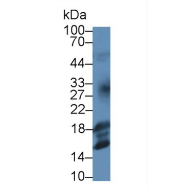Insulin Like Growth Factor 1 (IGF1) Human Monoclonal Antibody