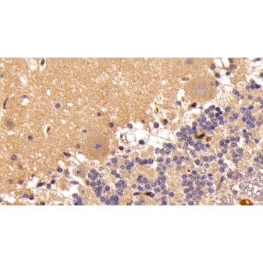 Insulin Like Growth Factor 1 (IGF1) Human Monoclonal Antibody