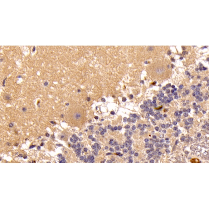 Insulin Like Growth Factor 1 (IGF1) Human Monoclonal Antibody