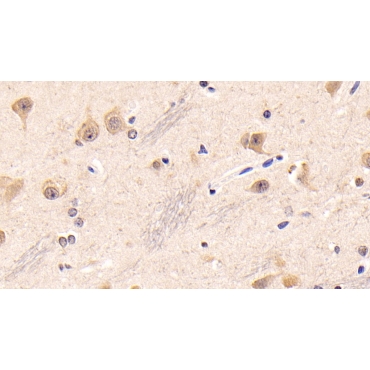 Insulin Like Growth Factor 1 (IGF1) Human Monoclonal Antibody