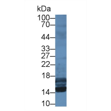 Insulin Like Growth Factor 1 (IGF1) Human Monoclonal Antibody