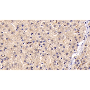 Insulin Like Growth Factor 1 (IGF1) Human Monoclonal Antibody
