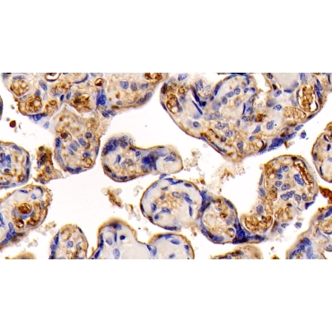 Insulin Like Growth Factor 1 (IGF1) Human Monoclonal Antibody