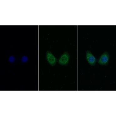 Insulin Like Growth Factor 1 (IGF1) Human Monoclonal Antibody