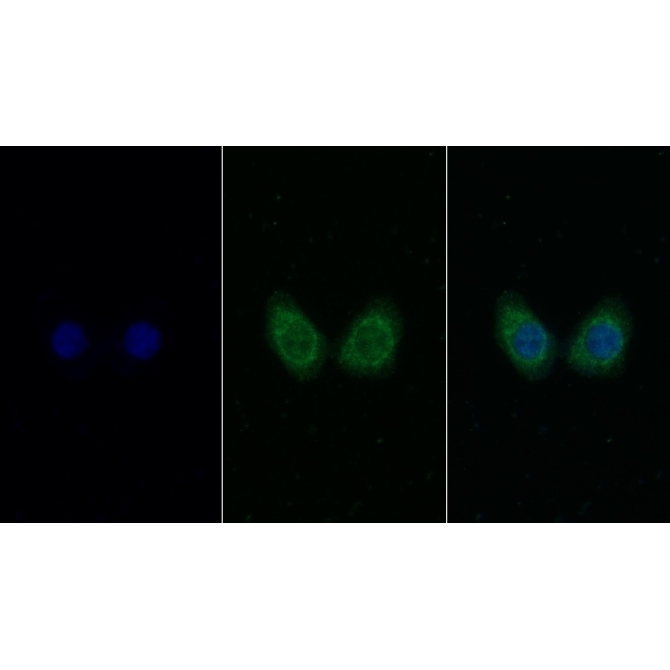 Insulin Like Growth Factor 1 (IGF1) Human Monoclonal Antibody